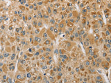 MIP Polyclonal Antibody Store at -20°C - MSE Supplies LLC