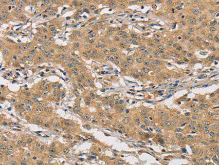 AMZ2 Polyclonal Antibody Store at -20°C - MSE Supplies LLC