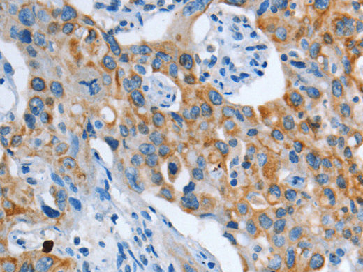 ASL Polyclonal Antibody Store at -20°C - MSE Supplies LLC