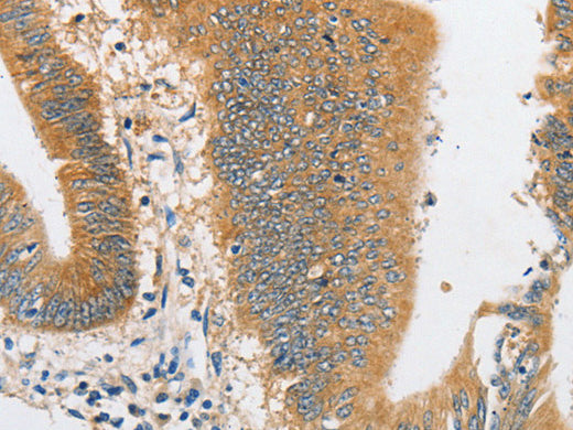 ARHGAP5 Polyclonal Antibody Store at -20°C - MSE Supplies LLC