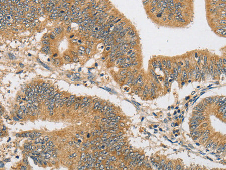 ARHGAP15 Polyclonal Antibody Store at -20°C - MSE Supplies LLC