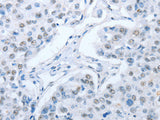 ARHGEF2 Polyclonal Antibody Store at -20°C - MSE Supplies LLC