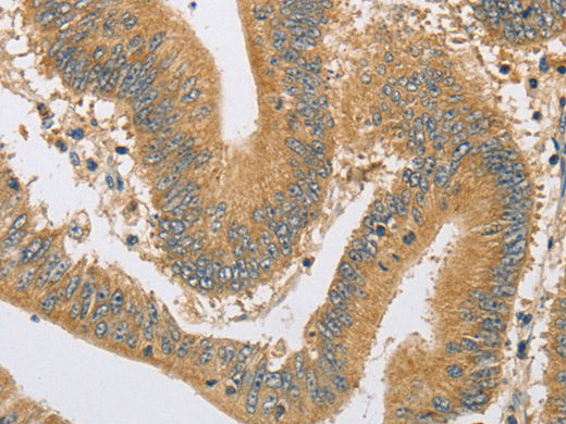 ARHGEF1 Polyclonal Antibody Store at -20°C - MSE Supplies LLC