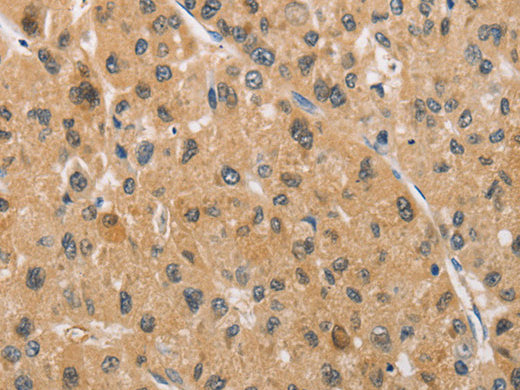ARMCX1 Polyclonal Antibody Store at -20°C - MSE Supplies LLC