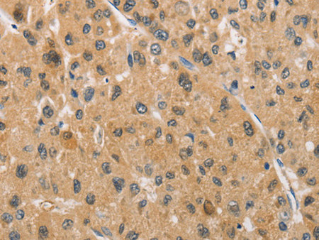 ARMCX1 Polyclonal Antibody Store at -20°C - MSE Supplies LLC