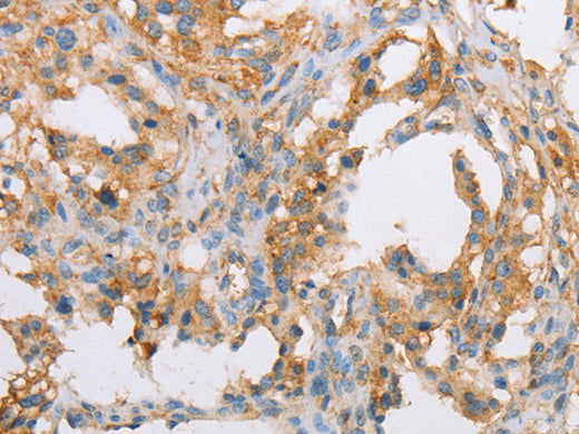 ACTR2 Polyclonal Antibody Store at -20°C - MSE Supplies LLC