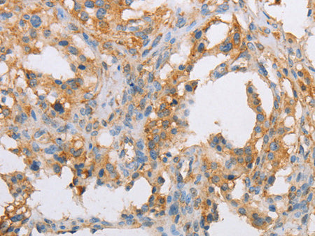 ACTR2 Polyclonal Antibody Store at -20°C - MSE Supplies LLC