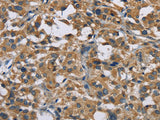 GAB1 Polyclonal Antibody Store at -20°C - MSE Supplies LLC
