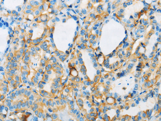 ARSA Polyclonal Antibody Store at -20°C - MSE Supplies LLC