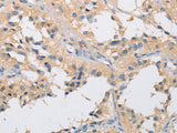 IKK Gamma Polyclonal Antibody Store at -20°C - MSE Supplies LLC