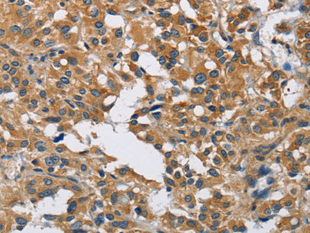 DNMT3A Polyclonal Antibody Store at -20°C - MSE Supplies LLC