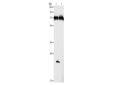 GDPD5 Polyclonal Antibody Store at -20°C - MSE Supplies LLC