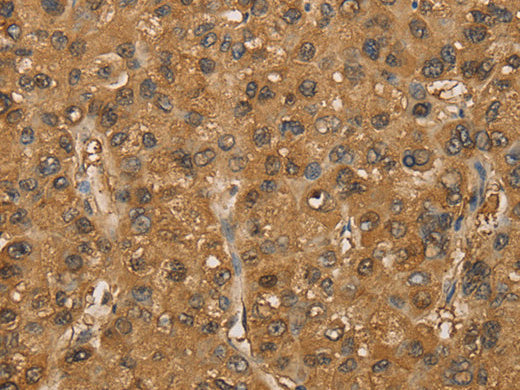 SETD2 Polyclonal Antibody Store at -20°C - MSE Supplies LLC