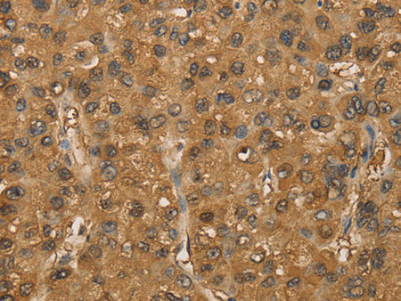 SETD2 Polyclonal Antibody Store at -20°C - MSE Supplies LLC
