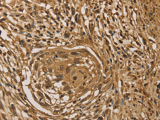 PRDM14 Polyclonal Antibody Store at -20°C - MSE Supplies LLC