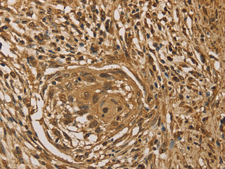 PRDM14 Polyclonal Antibody Store at -20°C - MSE Supplies LLC