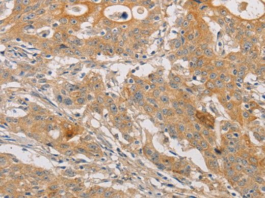 ARSK Polyclonal Antibody Store at -20°C - MSE Supplies LLC