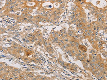 ARSK Polyclonal Antibody Store at -20°C - MSE Supplies LLC
