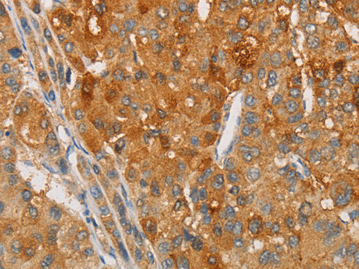 ARSG Polyclonal Antibody Store at -20°C - MSE Supplies LLC