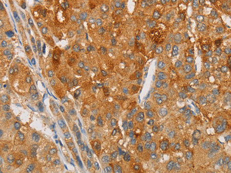 ARSG Polyclonal Antibody Store at -20°C - MSE Supplies LLC