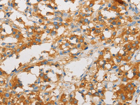 ART3 Polyclonal Antibody Store at -20°C - MSE Supplies LLC