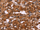 ART5 Polyclonal Antibody Store at -20°C - MSE Supplies LLC