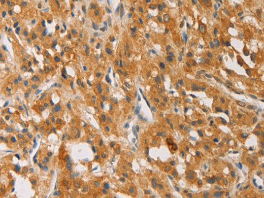 ATG4D Polyclonal Antibody Store at -20°C - MSE Supplies LLC
