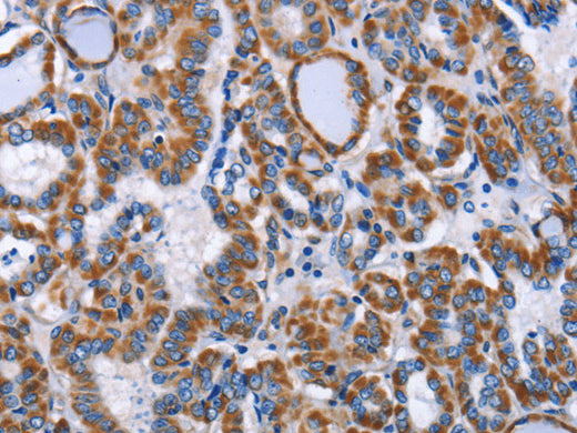 INTS10 Polyclonal Antibody Store at -20°C - MSE Supplies LLC