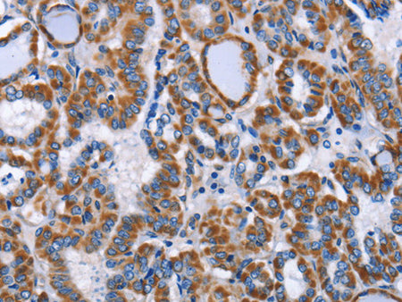 INTS10 Polyclonal Antibody Store at -20°C - MSE Supplies LLC