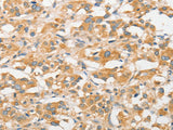 TLR5 Polyclonal Antibody Store at -20°C - MSE Supplies LLC