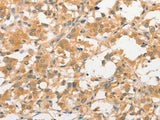 TLR3 Polyclonal Antibody Store at -20°C - MSE Supplies LLC