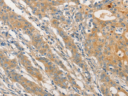 STAM Polyclonal Antibody Store at -20°C - MSE Supplies LLC