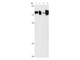 ACSL4 Polyclonal Antibody Store at -20°C - MSE Supplies LLC