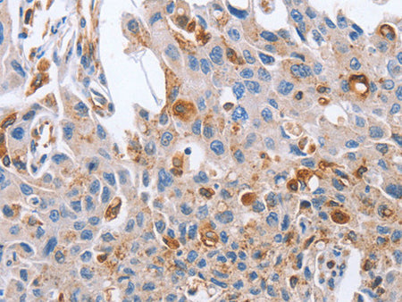 NRG4 Polyclonal Antibody Store at -20°C - MSE Supplies LLC