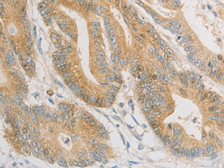 ZWINT Polyclonal Antibody Store at -20°C - MSE Supplies LLC