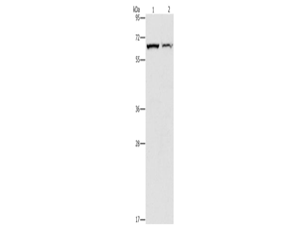 CBS Polyclonal Antibody Store at -20°C - MSE Supplies LLC