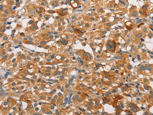 PKC Epsilon Polyclonal Antibody Store at -20°C - MSE Supplies LLC
