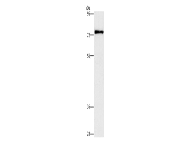 PKC Delta Polyclonal Antibody Store at -20°C - MSE Supplies LLC