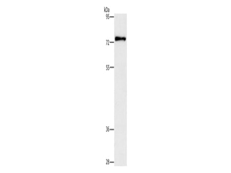 PKC Delta Polyclonal Antibody Store at -20°C - MSE Supplies LLC