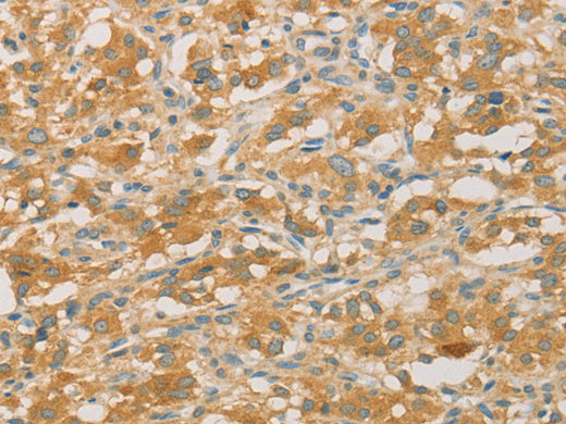 PRPSAP1 Polyclonal Antibody Store at -20°C - MSE Supplies LLC