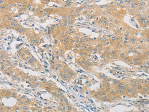 HIPK4 Polyclonal Antibody Store at -20°C - MSE Supplies LLC