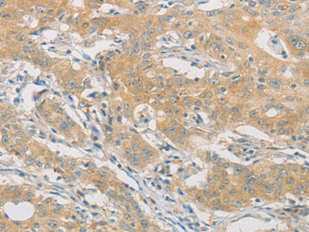 HIPK4 Polyclonal Antibody Store at -20°C - MSE Supplies LLC