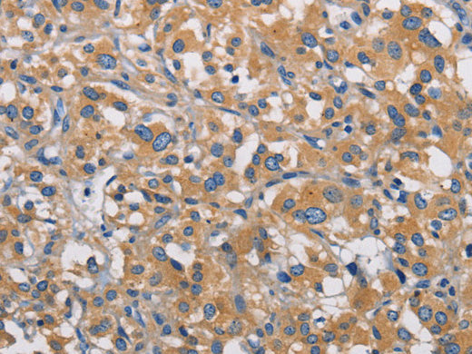 PIKFYVE Polyclonal Antibody Store at -20°C - MSE Supplies LLC