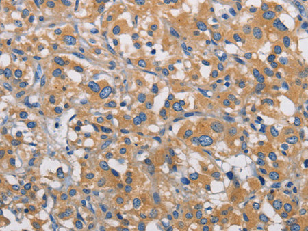 PIKFYVE Polyclonal Antibody Store at -20°C - MSE Supplies LLC