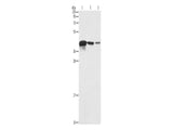 TWF2 Polyclonal Antibody Store at -20°C - MSE Supplies LLC