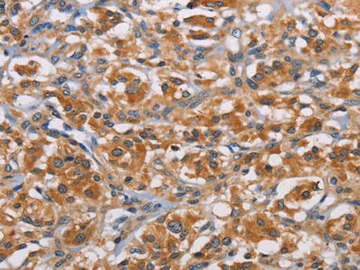 RICTOR Polyclonal Antibody Store at -20°C - MSE Supplies LLC