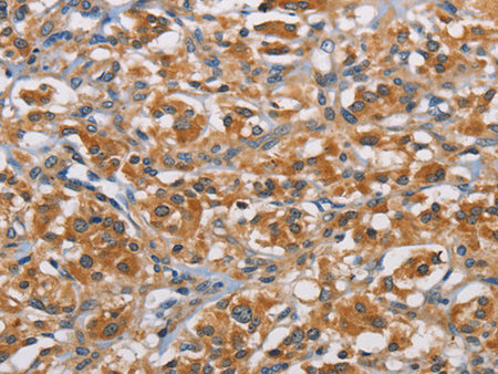 RICTOR Polyclonal Antibody Store at -20°C - MSE Supplies LLC