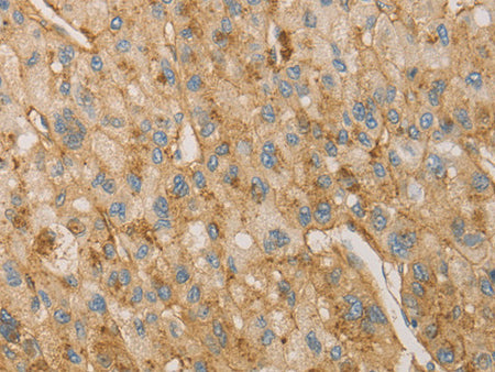 VTN Polyclonal Antibody Store at -20°C - MSE Supplies LLC