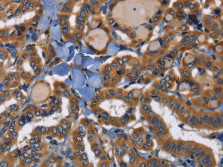 EPHB6 Polyclonal Antibody Store at -20°C - MSE Supplies LLC