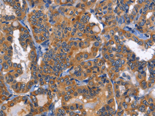 MUSK Polyclonal Antibody Store at -20°C - MSE Supplies LLC